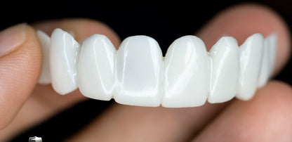 Removable Tooth Veneer with Natural Look for an Aesthetic Smile
