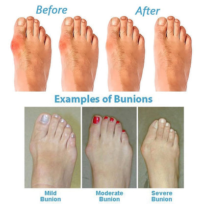 Sandals with Ladies' Orthopaedic Comfort Supportive Sole