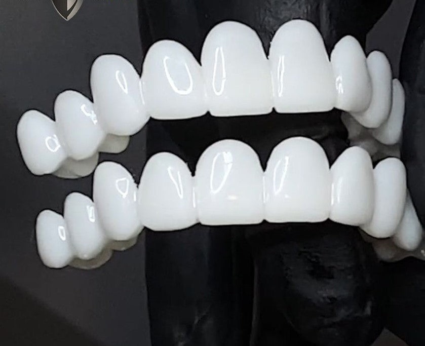 Removable Tooth Veneer with Natural Look for an Aesthetic Smile