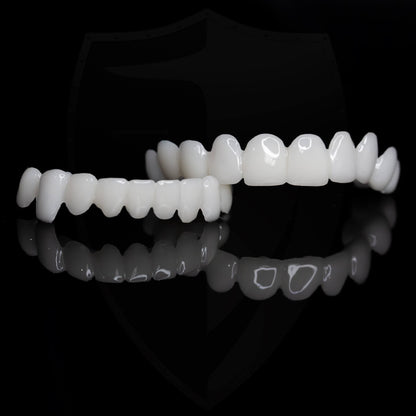 Removable Tooth Veneer with Natural Look for an Aesthetic Smile